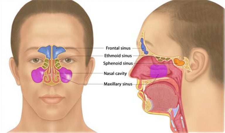 Massage For Headaches - Sinus Headache | Narayan Wellness Pleasanton, CA